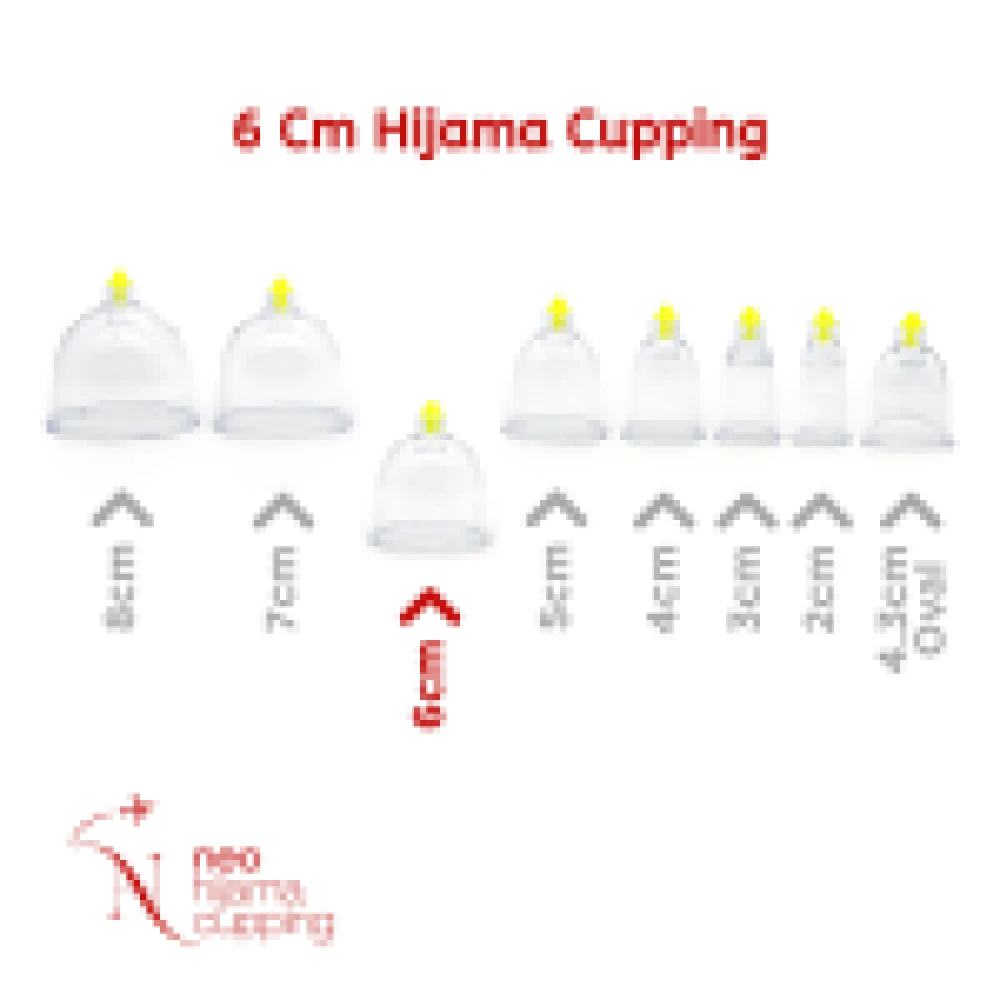 Hacamat Kupası 6 CM — 3